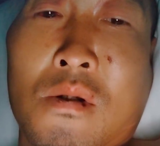 高空坠落杂技演员张凯流泪怀念亡妻：我不能倒下我们还有两个孩子(图1)